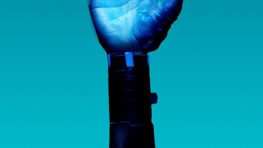 alt="Free Prosthetic Arm on Blue Background Stock Photo"